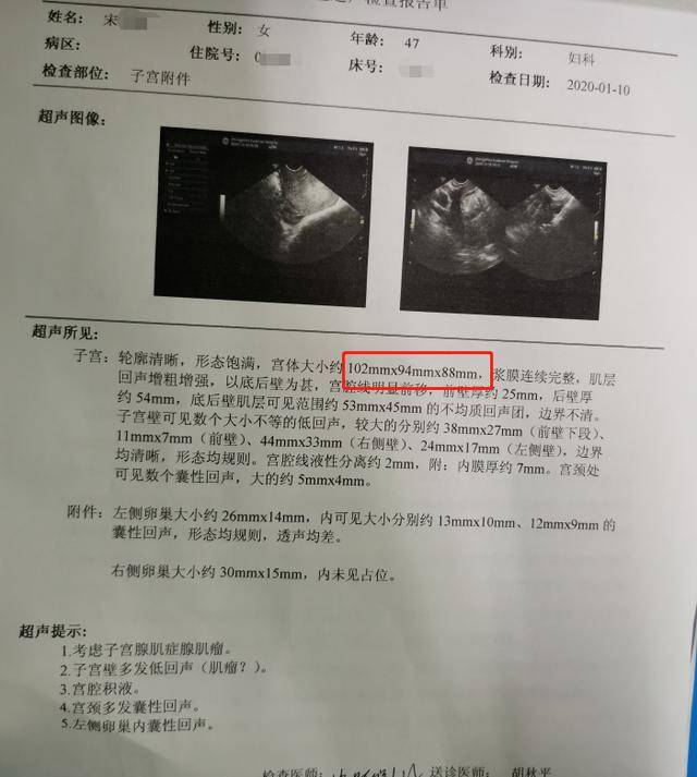 案例詳解曼月樂達菲林對於腺肌症的現實作用