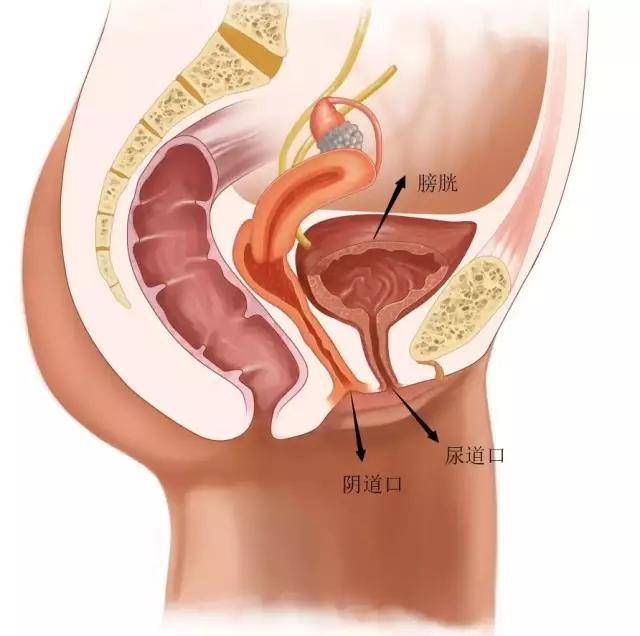 而性生活时,一些特殊姿势可能导致女性膀胱区受到压迫,引起内部压力