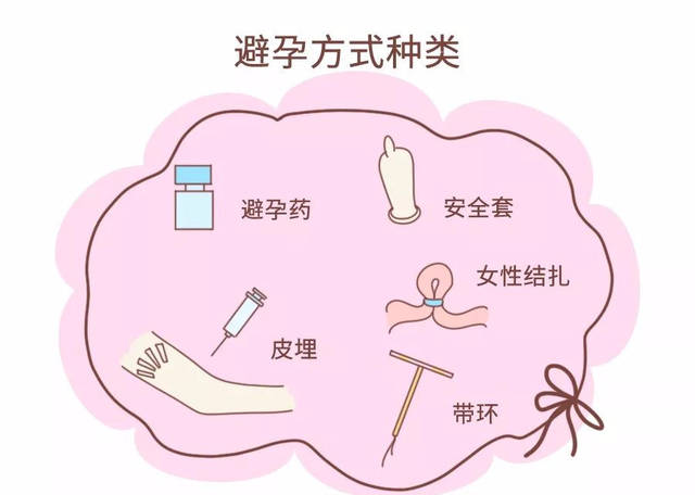 女性结扎 几种方法图片