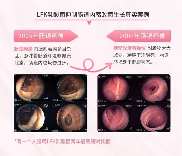 小身体大能量,呵护肠道健康,美翔疫情义赠活动全渠道开启!