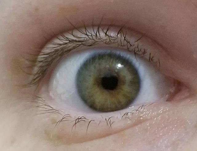 网友们列举自己身体的那些奇怪特征,简直脑洞大开.