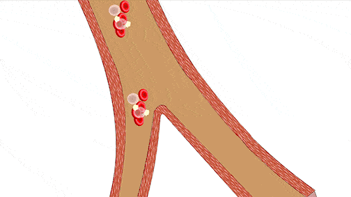 循环血流动态图图片
