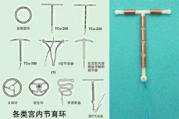 生娃后有一半女性在用这种方法避孕,却不知背后隐藏三大伤害