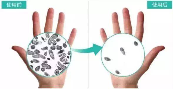 不洗手手上的细菌图片图片