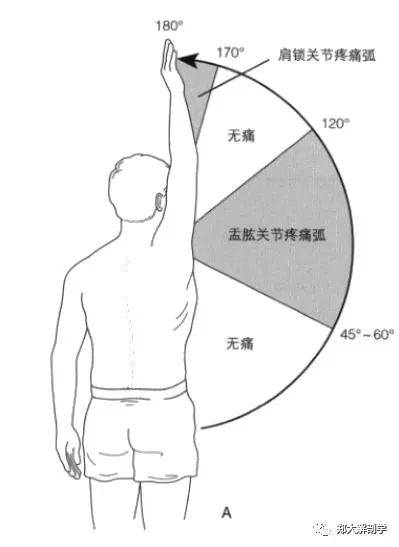 肩关节疼痛弧分析