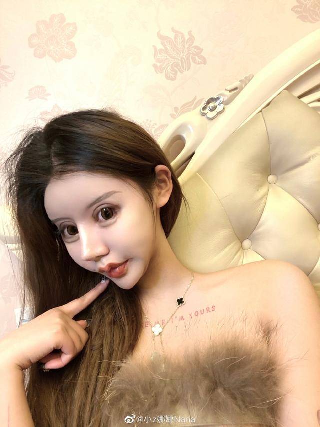 13岁整容,3年60次变"蛇精脸"被喷像鬼,她妈妈却这么说