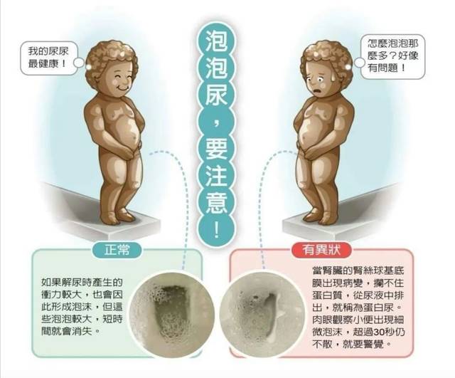 正常尿和蛋白尿图片图片