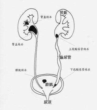 输尿管中段图片
