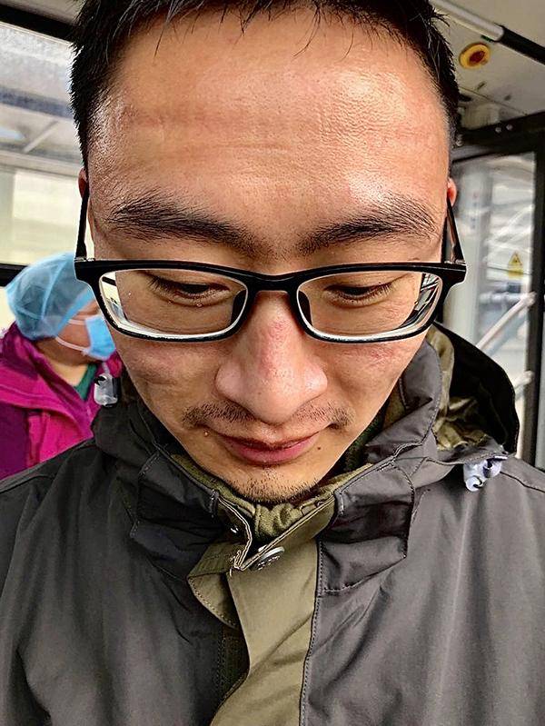 脱下防护服的黄小龙 脸上全是印痕