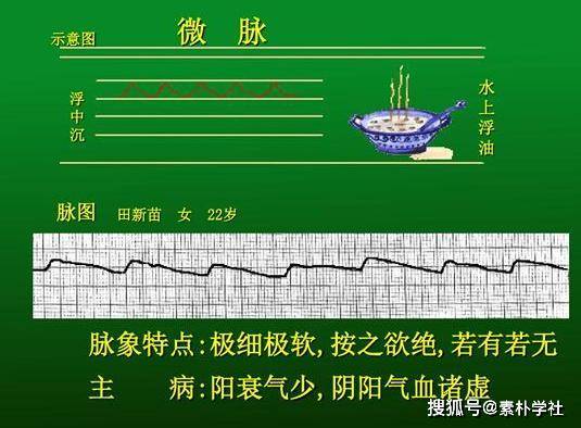 脉诊的核心部分:正常脉象与病理脉象各是什么触感?