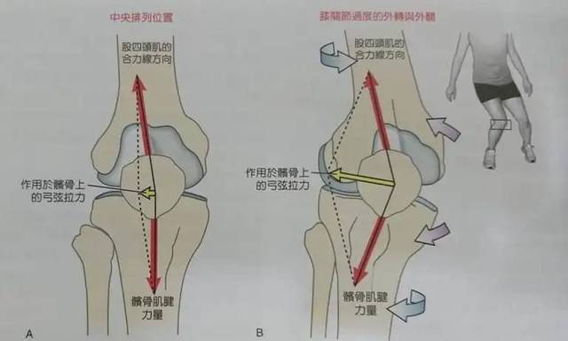 女性膝蓋疼痛普遍大於男性是為何?