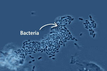 好在人体有强大的免疫系统(immune system),对许多病毒都具有抵抗力