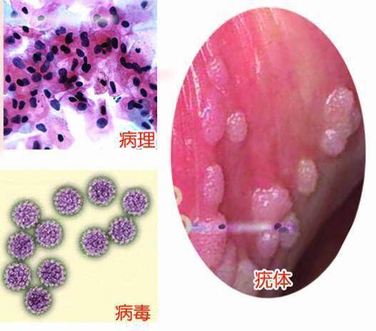 尖嘴湿犹图片