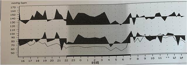 孕妇24小时动态血压图片