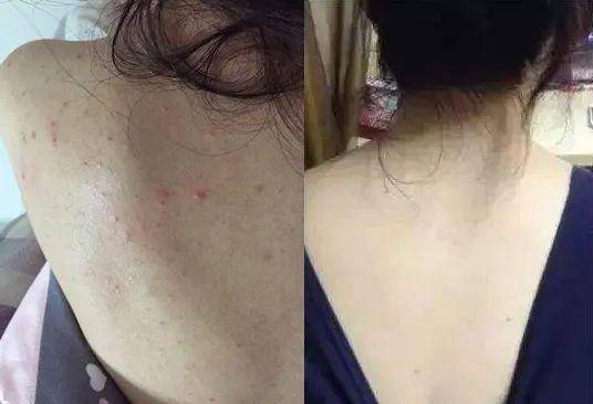 它比马桶脏530倍!你却每天用它洗衣,难怪过敏皮炎久治不愈