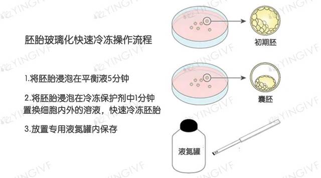 英医院在玻璃化冷冻基础上,拥有自己的专利操作步骤,保证胚胎的复苏率