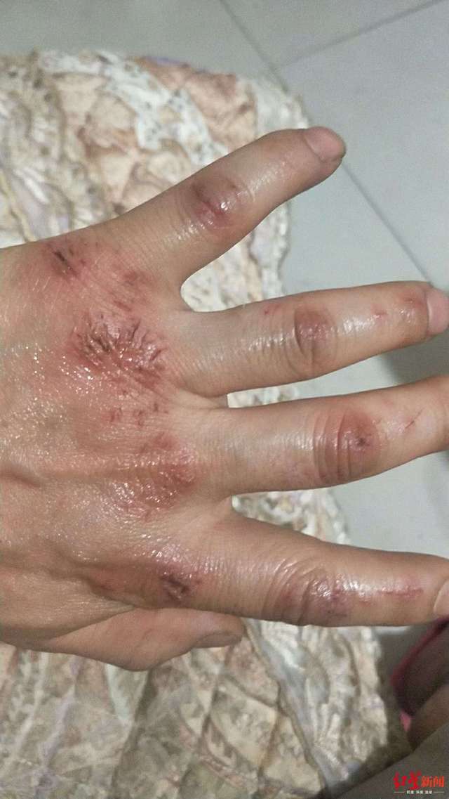 绵阳一家三口掉进沼气池1死2伤,小伙3次冒险救起3人_手机搜狐网