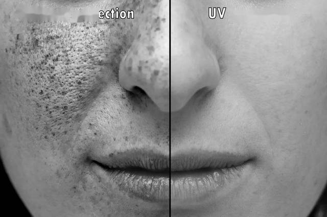 光老化有多可怕?bbc揭秘:75%的皮肤皱纹都是因为它