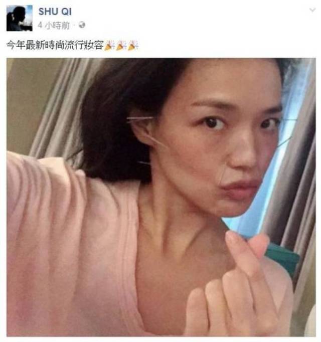 舒淇满脸扎针治过敏,恐怖的针灸美容真的靠谱吗?