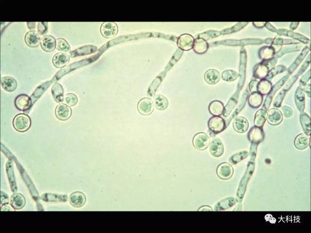 念珠菌显微镜下图片图片