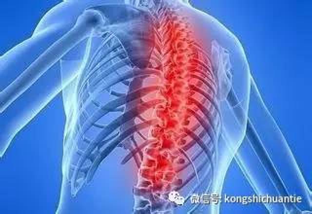 背痛位置图,右背痛位置图,背痛区域图(第10页)_大山谷图库
