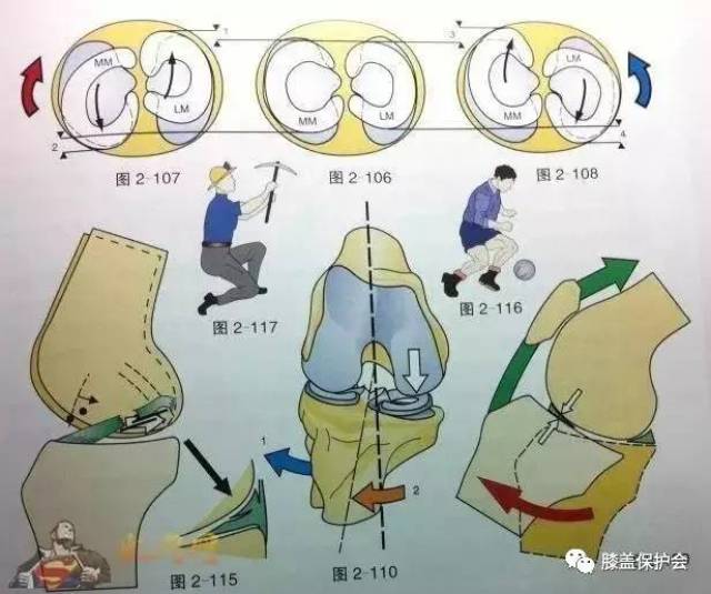运动关节系列之半月板损伤全解读