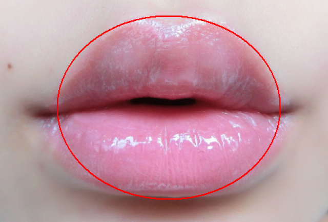 (上下嘴唇的高度与长度差不多) 嘟嘟唇只是肉多的话,就是香肠嘴