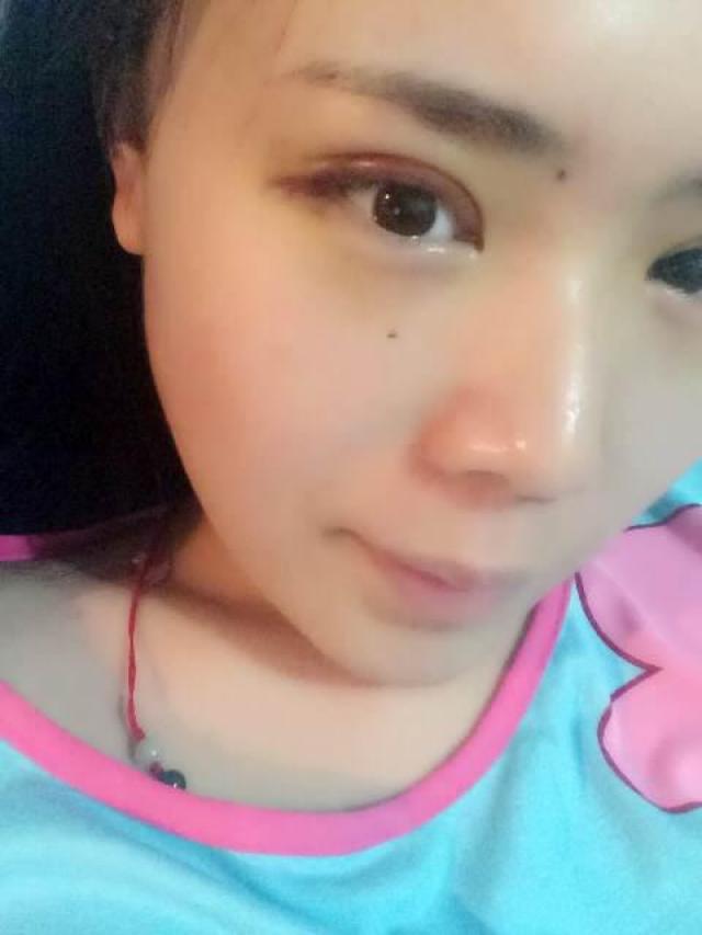 全切双眼皮,做的扇形的哦,满一个月了,很自然啦