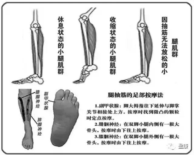 腿脚抽筋,学会这8招就够啦!