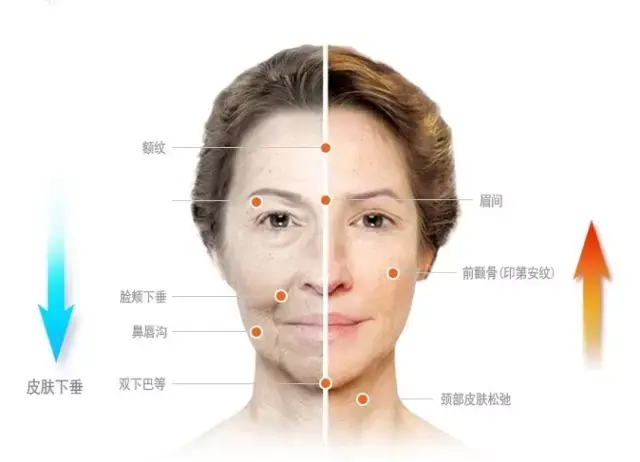 皮肤老化,皮肤老化,皮肤老化动图(第6页)_大山谷图库
