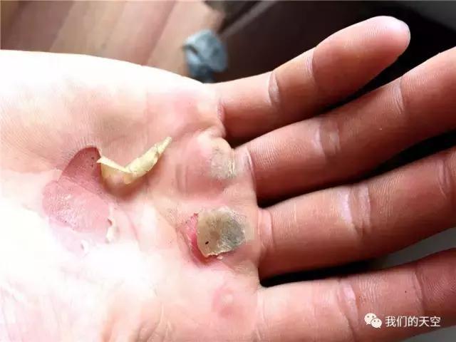 这是一双破了皮的手 怎么破的不重要 因为在这里 无数的战士都会有