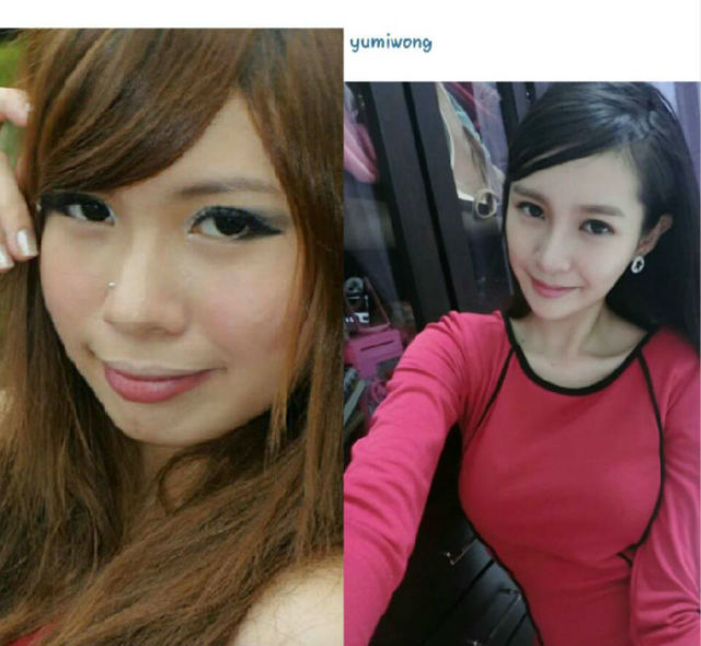 扒一扒30位网红整容前后大对比,真相太残忍