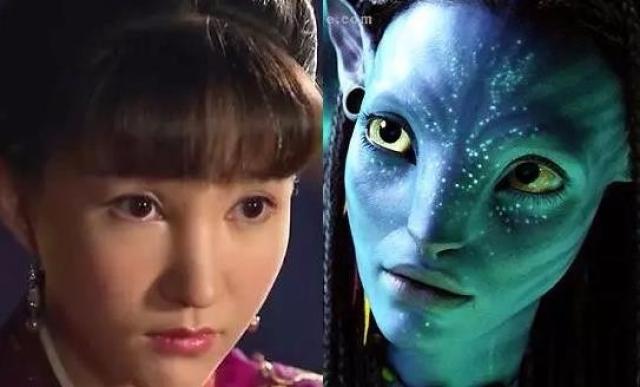 显秀气,如果鼻梁整的过宽,会显得粗笨,甚至畸形,如上图的"阿凡达鼻子"