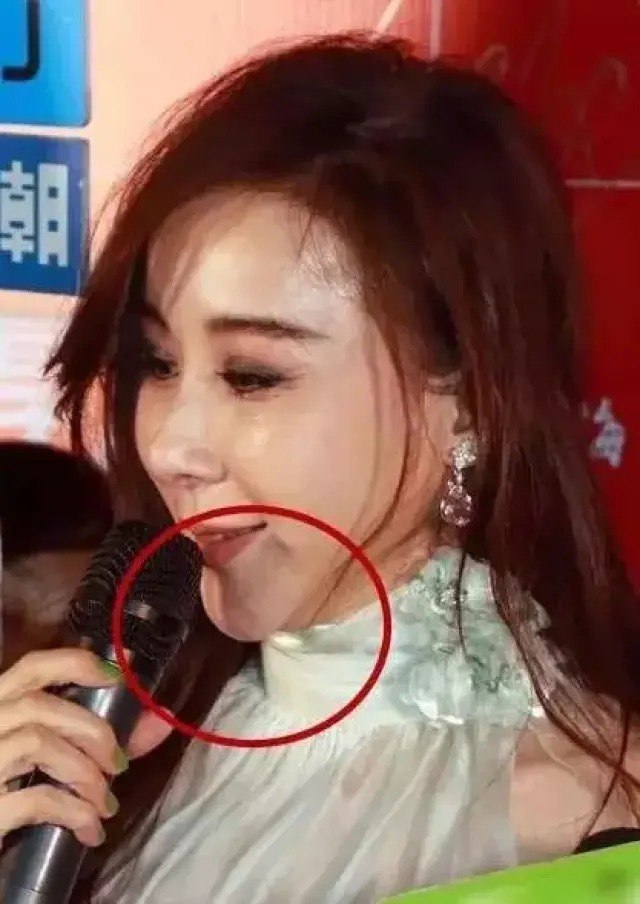 曾经的"台湾第一美人儿"因过度整容还不如小网红