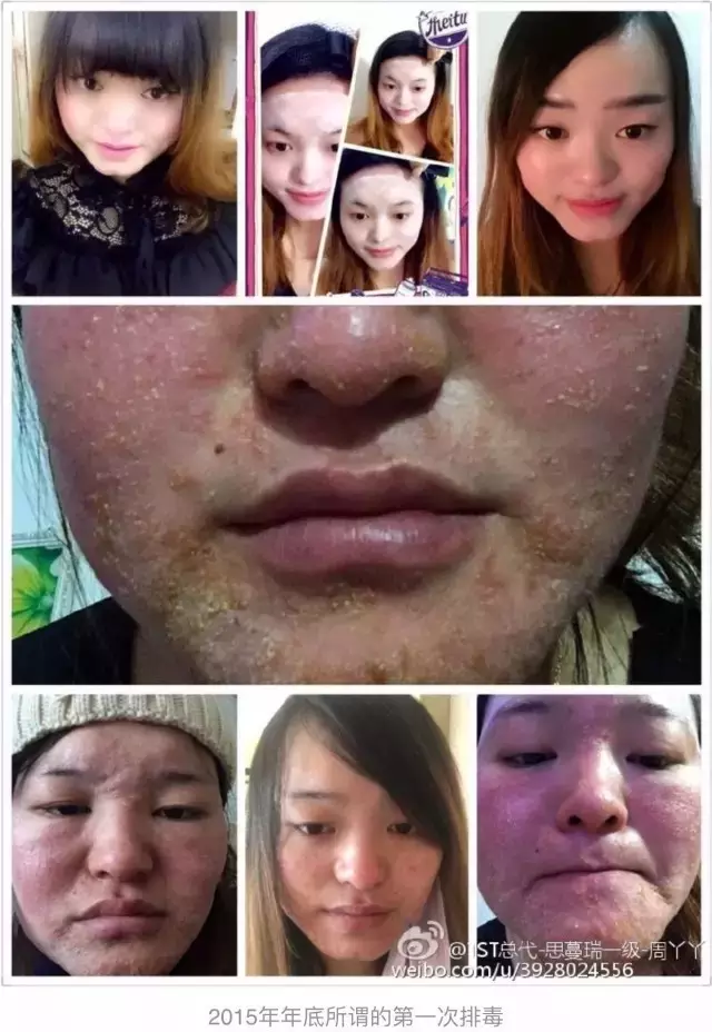 明星代言化妆品从来不使用,明星捞钱这么没底线?