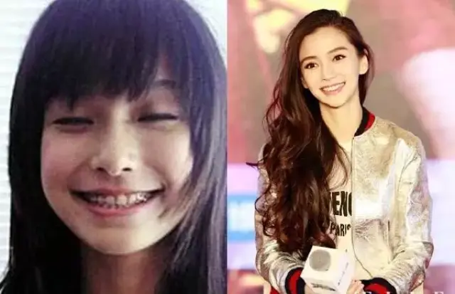 整容不如整牙,看完胡歌和大幂幂我信了!