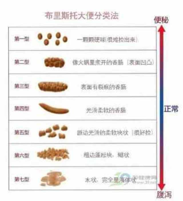 大便是扁平的图片图片