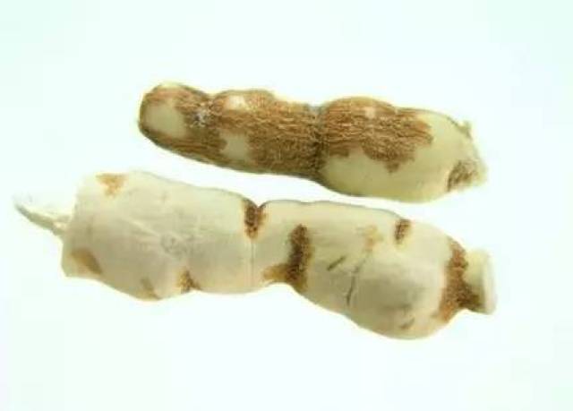 张锡纯:两次科举名落孙山,他不灰心丧气,靠拼命与努