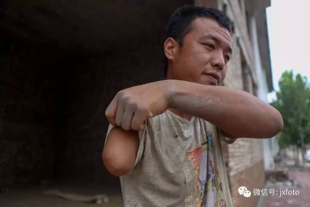 断臂小伙工地直播搬砖成网红,已拥有近80万粉丝