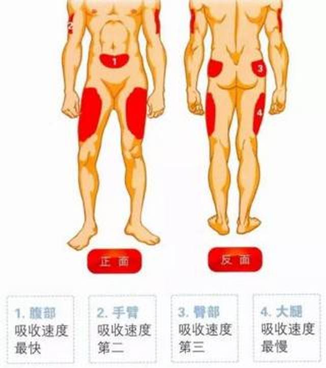 胰岛素打大腿的位置图图片