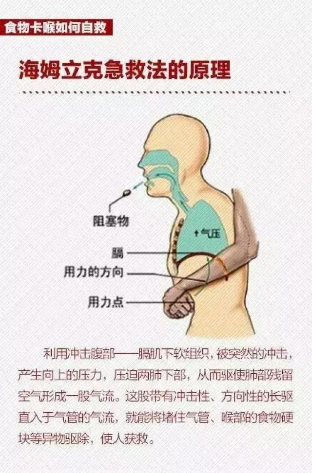 2岁女孩托儿所异物卡入气管,抢救生命的关键4分钟大人应该这样做!
