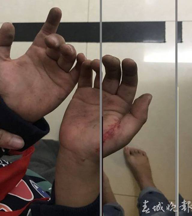 电梯突然从高空坠下,里面传来8岁男孩撕心裂肺的叫声…又是因为