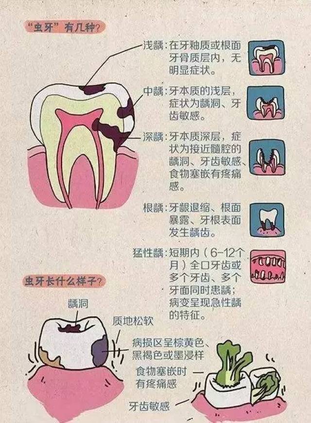 你的"虫牙"是怎么来的