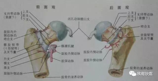 股骨头缺血性坏死丨分期及x,ct,mri表现