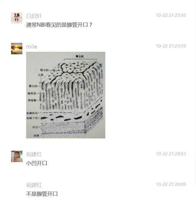 镜徒讨论 | 每周一词——胃小凹